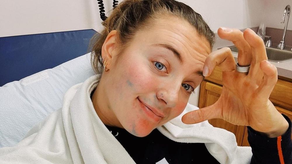 Schwere Verletzung für Ski-Weltmeisterin.