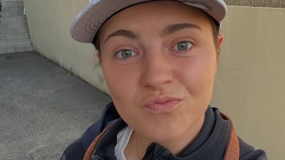 Fatales-Missgeschick-Ski-Ass-bel-verletzt