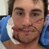 Für ein beliebtes Ski-Ass ist der Olympia-Traum geplatzt.