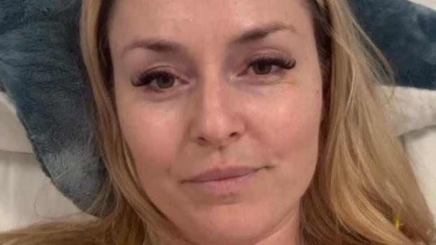 Lindsey Vonn hat sich einer weiteren Operation unterzogen. © Social Media