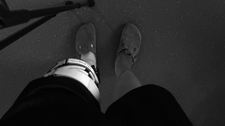 Martin-Luis Walch zeigt sein lädiertes Knie. © Instagram/maluwalch