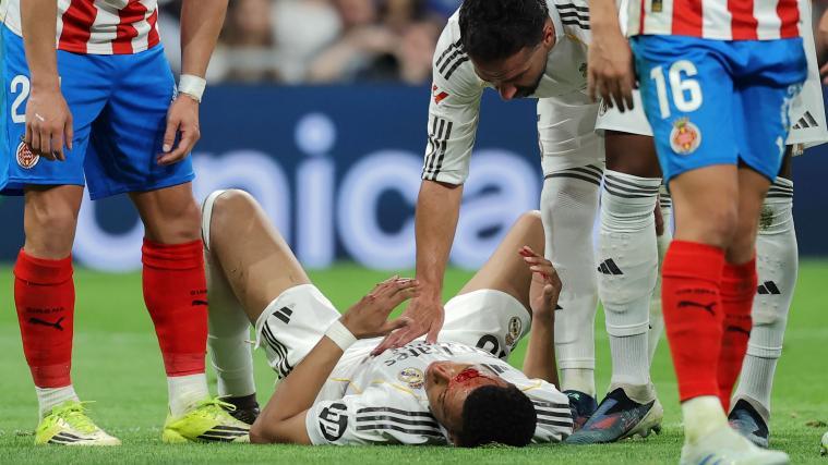 Kylian Mbappe hat am Wochenende eine Wunde am Kopf erlitten. © APA/afp / THOMAS COEX